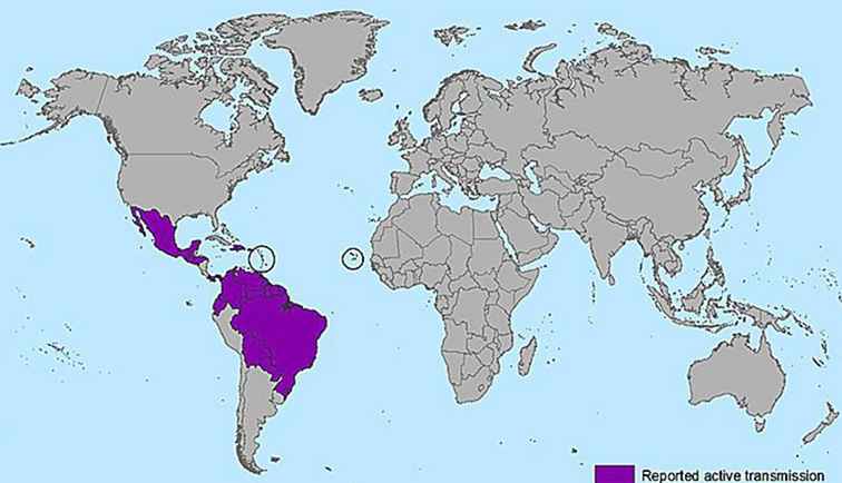 Qu'est-ce que le virus Zika et que faut-il savoir?